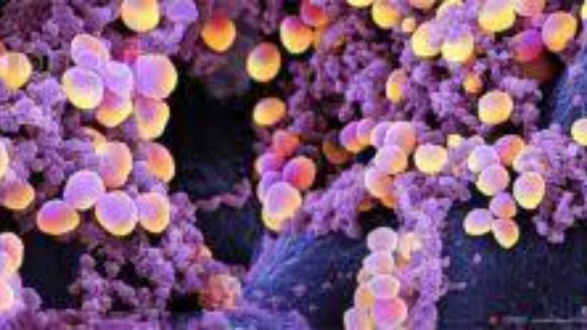 Batterio mangiacarne, una vecchia conoscenza