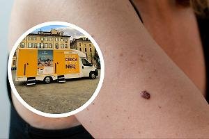 Un giorno per la salute della pelle: “Cerca il tuo neo” sbarca a Torino con screening gratuiti ed educazione preventiva